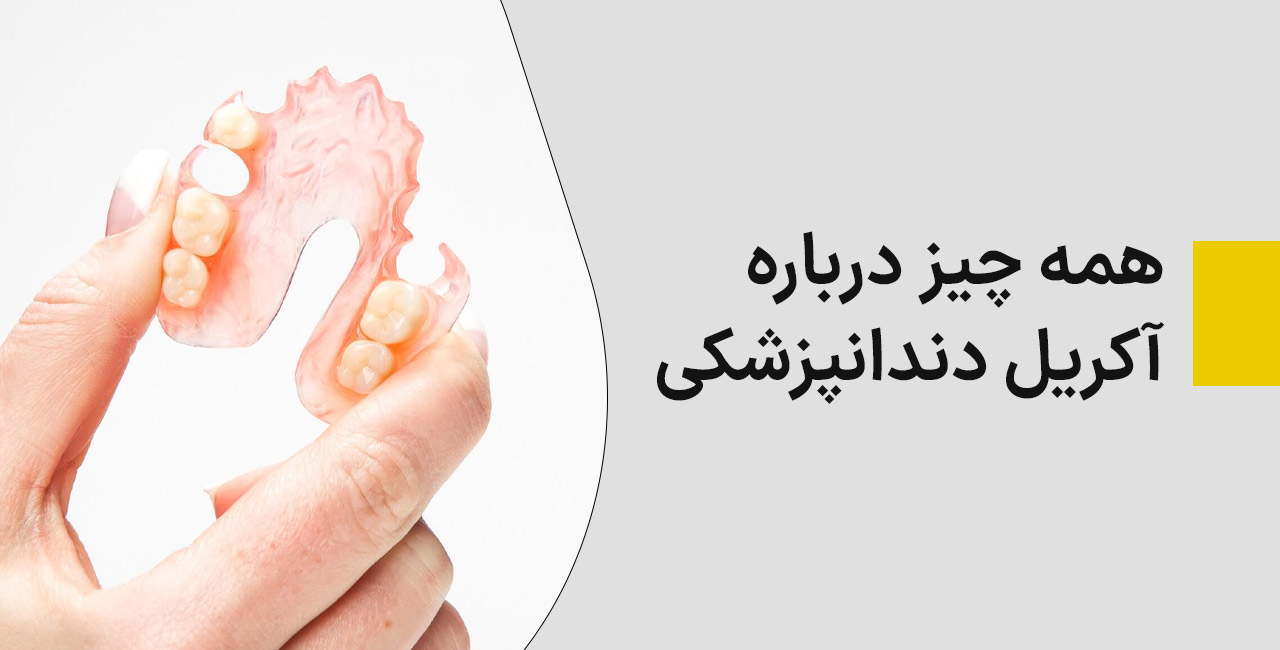 همه چیز درباره آکریل دندانپزشکی