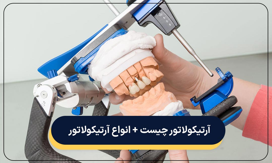 آرتیکولاتور چیست + انواع ارتیکولاتور