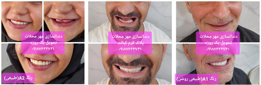 دندانسازی مهر محلات