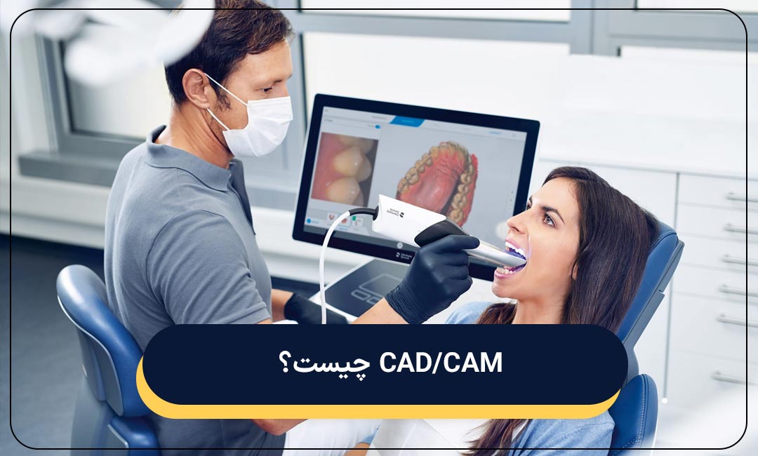 کدکم چیست؟