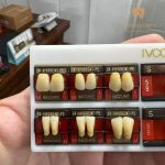 دندان ایووکلار قاب سفید جفت چین لیختن اشتاین - تصویر 2
