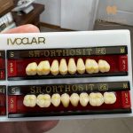دندان ایووکلار قاب سفید جفت چین لیختن اشتاین - تصویر 3