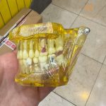 ماکت نشکن آموزشی ایمپلنت دندانپزشکی - تصویر 4